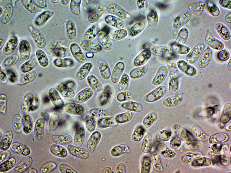 Una corticale granulare da identificare